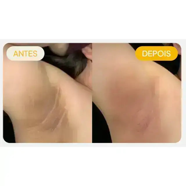 Crema Adeus Correctora de Manchas Oscuras – 100g / 3.52 oz
