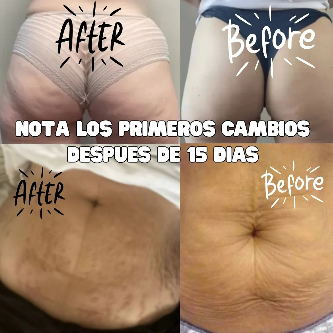 Crema Adeus Original Brasileña — Crema Corporal para Celulitis, Flacidez, Foliculitis ,Grasa localizada  y Estrías (300g)